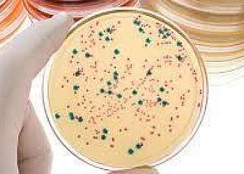 Análise de água microbiologia Análise de água microbiologia
