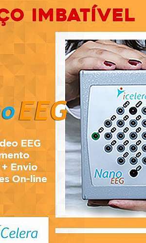 Comprar eeg portátil Comprar eeg portátil